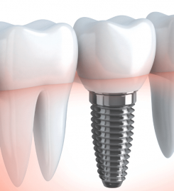 Clinica Dental Gandara